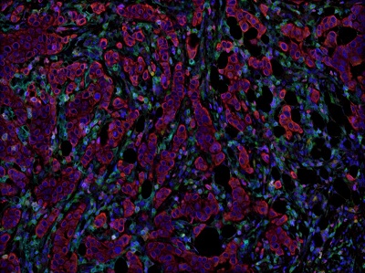 Multiplex immunohistochemistry - Anti-EpCAM antibody [EPR20532-225] (ab223582), expandable thumbnail