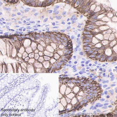 Immunohistochemistry (Formalin/PFA-fixed paraffin-embedded sections) - Anti-EpCAM antibody [EPR20532-225] - BSA and Azide free (AB225894)
