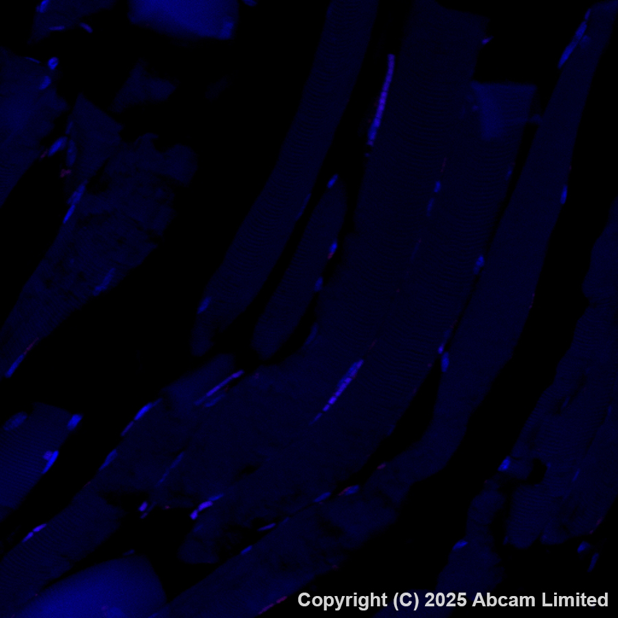 Immunohistochemistry (Formalin/PFA-fixed paraffin-embedded sections) - Anti-EpCAM/CD326 antibody [EPR20532-225] - BSA and Azide free (AB225894)