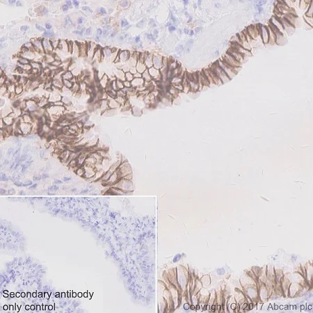 Immunohistochemistry (Formalin/PFA-fixed paraffin-embedded sections) - Anti-EpCAM antibody [EPR20533-266] (AB213501)