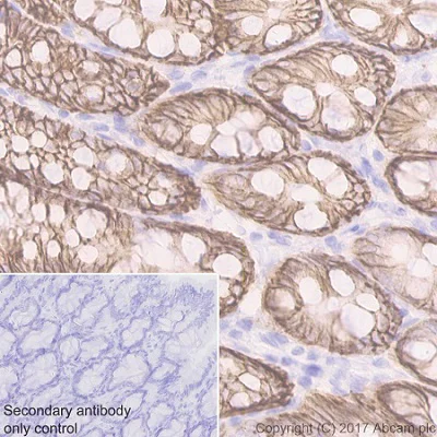 Immunohistochemistry (Formalin/PFA-fixed paraffin-embedded sections) - Anti-EpCAM antibody [EPR20533-266] - BSA and Azide free (AB232437)