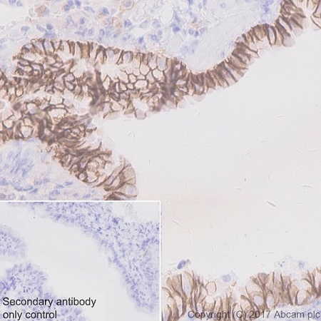 Immunohistochemistry (Formalin/PFA-fixed paraffin-embedded sections) - Anti-EpCAM antibody [EPR20533-266] - BSA and Azide free (AB232437), expandable thumbnail