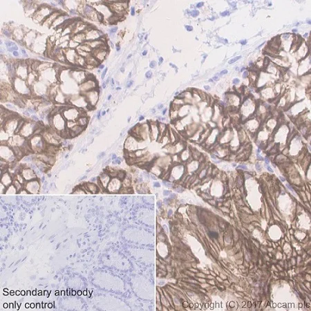 Immunohistochemistry (Formalin/PFA-fixed paraffin-embedded sections) - Anti-EpCAM antibody [EPR20533-266] - BSA and Azide free (AB232437)