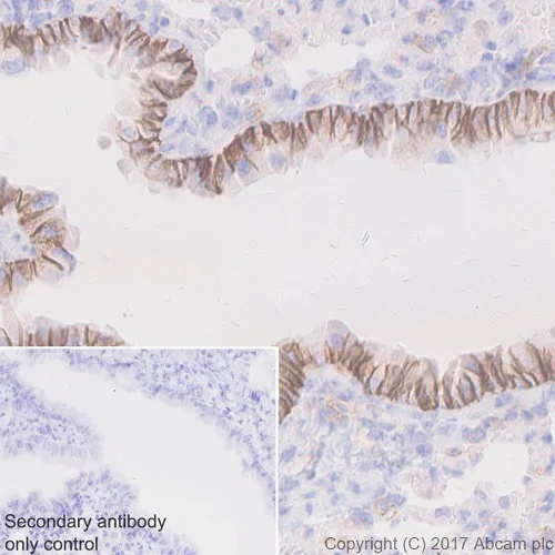 Immunohistochemistry (Formalin/PFA-fixed paraffin-embedded sections) - Anti-EpCAM antibody [EPR20533-63] - BSA and Azide free (AB228876)