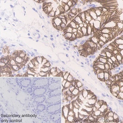 Immunohistochemistry (Formalin/PFA-fixed paraffin-embedded sections) - Anti-EpCAM antibody [EPR20533-63] - BSA and Azide free (AB228876)