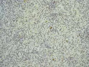 Immunohistochemistry (Formalin/PFA-fixed paraffin-embedded sections) - Anti-EpCAM antibody [EPR677(2)] (AB124825)