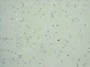 Immunohistochemistry (Formalin/PFA-fixed paraffin-embedded sections) - Anti-EpCAM antibody [EPR677(2)] (AB124825)