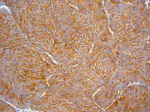 Immunohistochemistry (Formalin/PFA-fixed paraffin-embedded sections) - Anti-EpCAM antibody [EPR677(2)] (AB124825)
