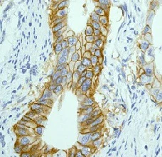 Immunohistochemistry (Formalin/PFA-fixed paraffin-embedded sections) - Anti-EpCAM antibody [EPR677(2)] - BSA and Azide free (AB219364)