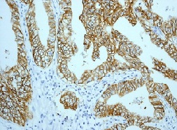 Immunohistochemistry (Formalin/PFA-fixed paraffin-embedded sections) - Anti-EpCAM antibody [EPR677(2)] - BSA and Azide free (AB219364), expandable thumbnail
