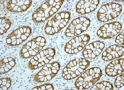 Immunohistochemistry (Formalin/PFA-fixed paraffin-embedded sections) - Anti-EpCAM antibody [EPR677(2)] - BSA and Azide free (AB219364)