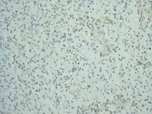 Immunohistochemistry (Formalin/PFA-fixed paraffin-embedded sections) - Anti-EpCAM antibody [EPR677(2)] - BSA and Azide free (ab219364), expandable thumbnail