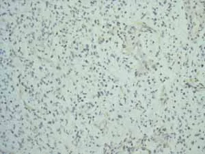 Immunohistochemistry (Formalin/PFA-fixed paraffin-embedded sections) - Anti-EpCAM antibody [EPR677(2)] - BSA and Azide free (AB219364)
