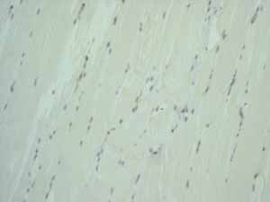 Immunohistochemistry (Formalin/PFA-fixed paraffin-embedded sections) - Anti-EpCAM antibody [EPR677(2)] - BSA and Azide free (ab219364), expandable thumbnail