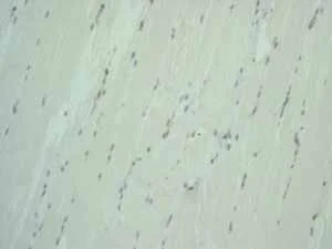 Immunohistochemistry (Formalin/PFA-fixed paraffin-embedded sections) - Anti-EpCAM antibody [EPR677(2)] - BSA and Azide free (AB219364)