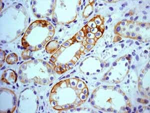 Immunohistochemistry (Formalin/PFA-fixed paraffin-embedded sections) - Anti-EpCAM antibody [EPR677(2)] - BSA and Azide free (AB219364), expandable thumbnail