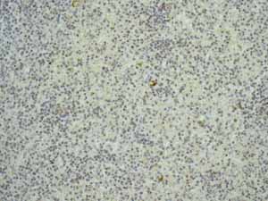 Immunohistochemistry (Formalin/PFA-fixed paraffin-embedded sections) - Anti-EpCAM antibody [EPR677(2)] - BSA and Azide free (ab219364), expandable thumbnail
