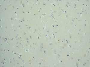 Immunohistochemistry (Formalin/PFA-fixed paraffin-embedded sections) - Anti-EpCAM antibody [EPR677(2)] - BSA and Azide free (ab219364), expandable thumbnail