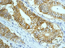 Immunohistochemistry (Formalin/PFA-fixed paraffin-embedded sections) - Anti-EpCAM antibody [EPR677(2)] - BSA and Azide free (AB219364)