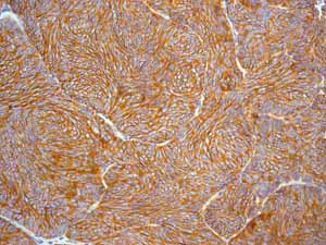 Immunohistochemistry (Formalin/PFA-fixed paraffin-embedded sections) - Anti-EpCAM antibody [EPR677(2)] - BSA and Azide free (AB219364), expandable thumbnail