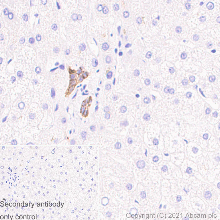 Immunohistochemistry (Formalin/PFA-fixed paraffin-embedded sections) - Anti-EpCAM antibody [RM1016] (AB282457)