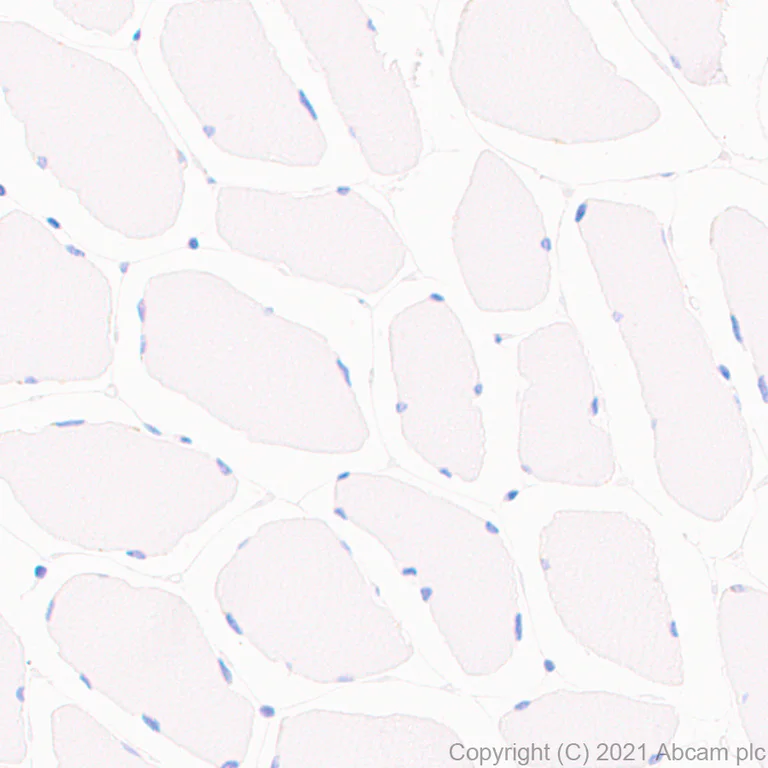 Immunohistochemistry (Formalin/PFA-fixed paraffin-embedded sections) - Anti-EpCAM antibody [RM1016] (AB282457)