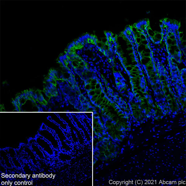 Immunohistochemistry (Frozen sections) - Anti-EpCAM antibody [RM1016] (AB282457)