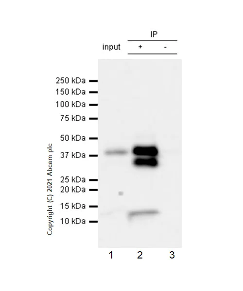 Immunoprecipitation - Anti-EpCAM antibody [RM1016] (AB282457)