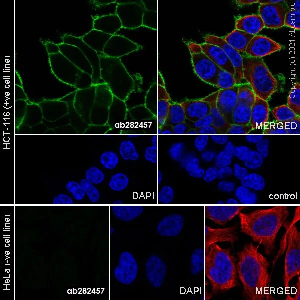 Immunocytochemistry - Anti-EpCAM antibody [RM1016] - BSA and Azide free (AB283866)