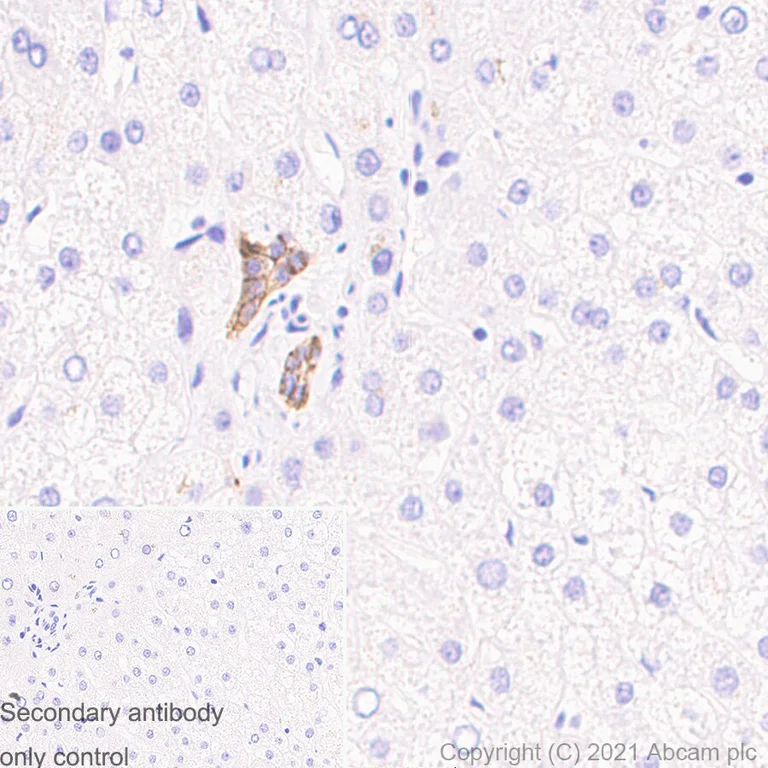 Immunohistochemistry (Formalin/PFA-fixed paraffin-embedded sections) - Anti-EpCAM antibody [RM1016] - BSA and Azide free (AB283866)