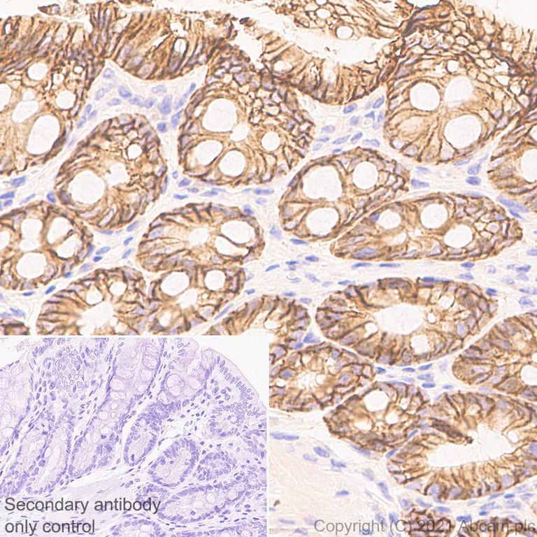 Immunohistochemistry (Formalin/PFA-fixed paraffin-embedded sections) - Anti-EpCAM antibody [RM1016] - BSA and Azide free (AB283866)