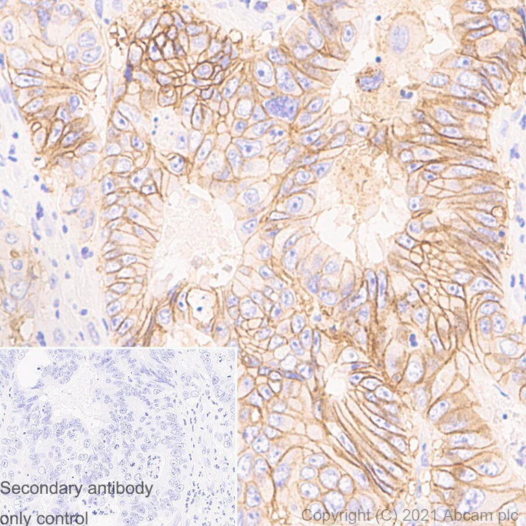 Immunohistochemistry (Formalin/PFA-fixed paraffin-embedded sections) - Anti-EpCAM antibody [RM1016] - BSA and Azide free (AB283866)