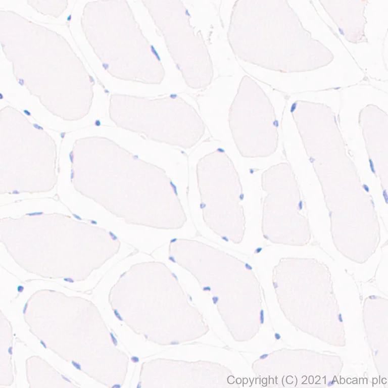 Immunohistochemistry (Formalin/PFA-fixed paraffin-embedded sections) - Anti-EpCAM antibody [RM1016] - BSA and Azide free (AB283866)
