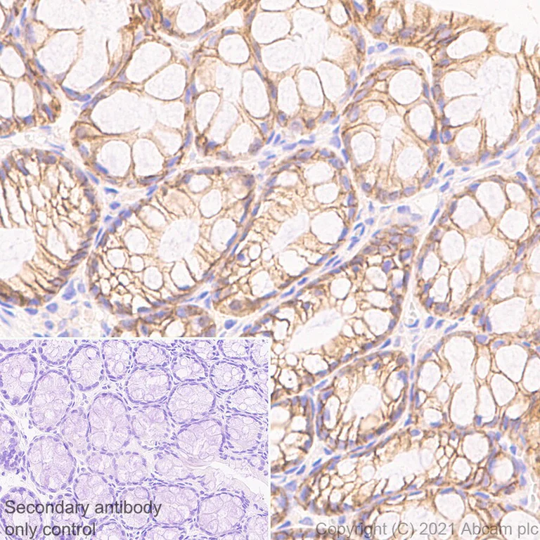 Immunohistochemistry (Formalin/PFA-fixed paraffin-embedded sections) - Anti-EpCAM antibody [RM1016] - BSA and Azide free (AB283866)