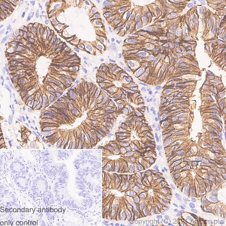 Immunohistochemistry (Formalin/PFA-fixed paraffin-embedded sections) - Anti-EpCAM antibody [RM1016] - BSA and Azide free (AB283866)