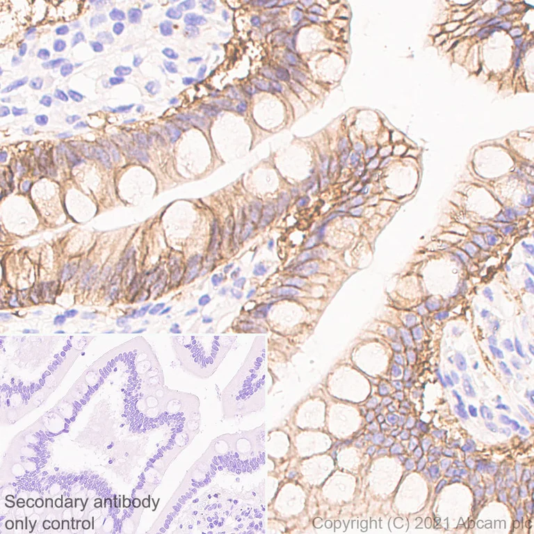 Immunohistochemistry (Formalin/PFA-fixed paraffin-embedded sections) - Anti-EpCAM antibody [RM1016] - BSA and Azide free (AB283866)