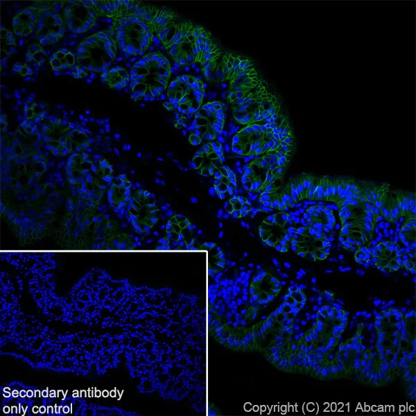 Immunohistochemistry (Frozen sections) - Anti-EpCAM antibody [RM1016] - BSA and Azide free (AB283866)