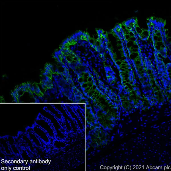 Immunohistochemistry (Frozen sections) - Anti-EpCAM antibody [RM1016] - BSA and Azide free (AB283866)