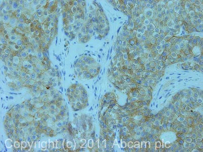 Immunohistochemistry (Formalin/PFA-fixed paraffin-embedded sections) - EpCAM (EPR20532-225, AUA1, EPR20532-222, EPR677(2)) Antibody Sampler Panel - Human, IHC (AB269810)