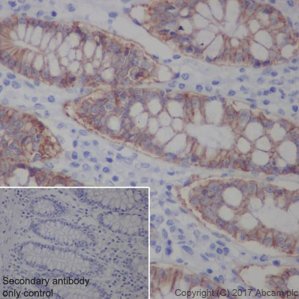 Immunohistochemistry (Formalin/PFA-fixed paraffin-embedded sections) - EpCAM (EPR20532-225, AUA1, EPR20532-222, EPR677(2)) Antibody Sampler Panel - Human, IHC (AB269810)