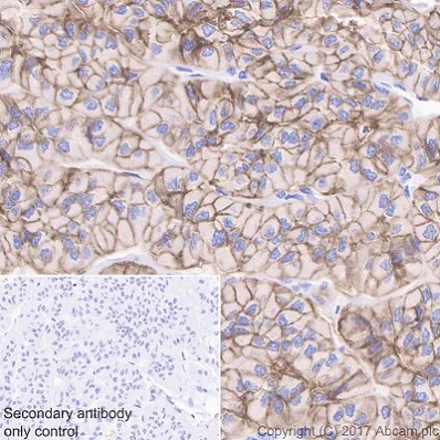 Immunohistochemistry (Formalin/PFA-fixed paraffin-embedded sections) - EpCAM (EPR20532-225, AUA1, EPR20532-222, EPR677(2)) Antibody Sampler Panel - Human, IHC (AB269810)