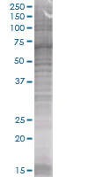 SDS-PAGE - EpCAM overexpression 293T lysate (whole cell) (AB94132)