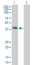 Western blot - EpCAM overexpression 293T lysate (whole cell) (AB94132)