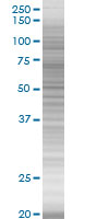 SDS-PAGE - EpCAM overexpression 293T lysate (whole cell) (AB94133), expandable thumbnail