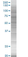 SDS-PAGE - EpCAM overexpression 293T lysate (whole cell) (AB94133)