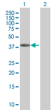 Western blot - EpCAM overexpression 293T lysate (whole cell) (AB94133), expandable thumbnail