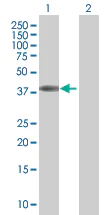 Western blot - EpCAM overexpression 293T lysate (whole cell) (AB94133)