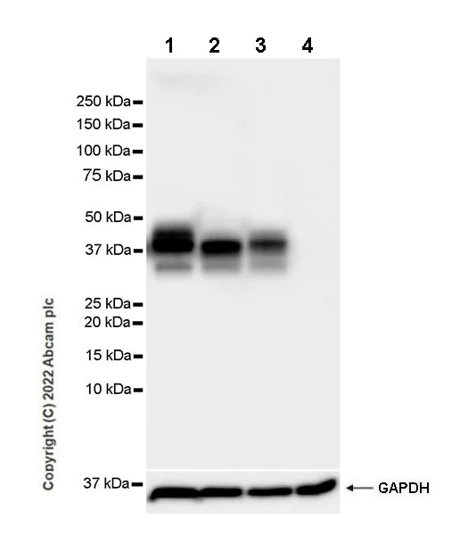 Western blot - Anti-EPCR/CD201 antibody [EPR25647-49] (AB300565)