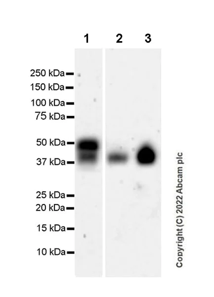 Western blot - Anti-EPCR/CD201 antibody [EPR25647-49] (AB300565)