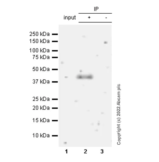 Immunoprecipitation - Anti-EPCR/CD201 antibody [EPR25647-5] (AB300525)